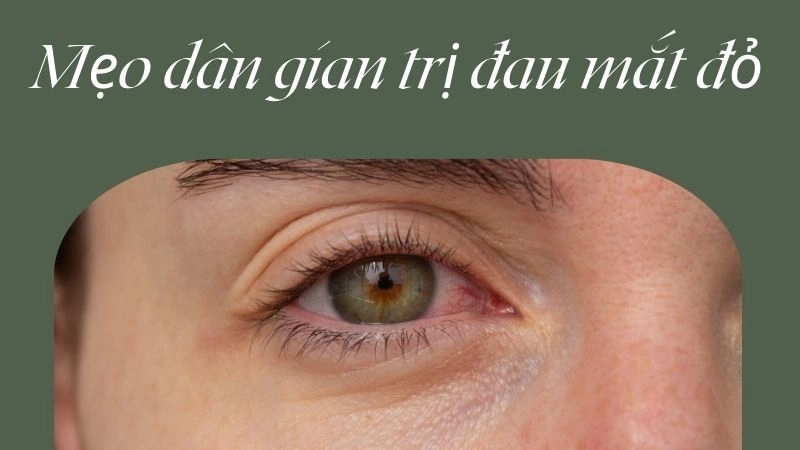 Chườm ấm – dịu ngay cơn rát mắt